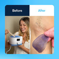 Back waxing kit