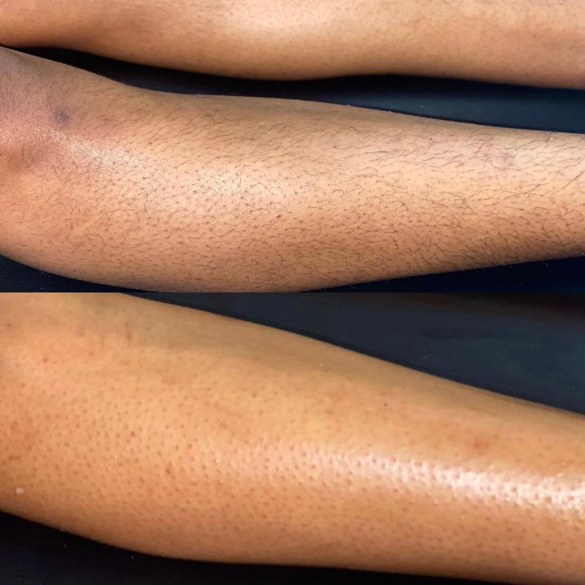 before-after-image