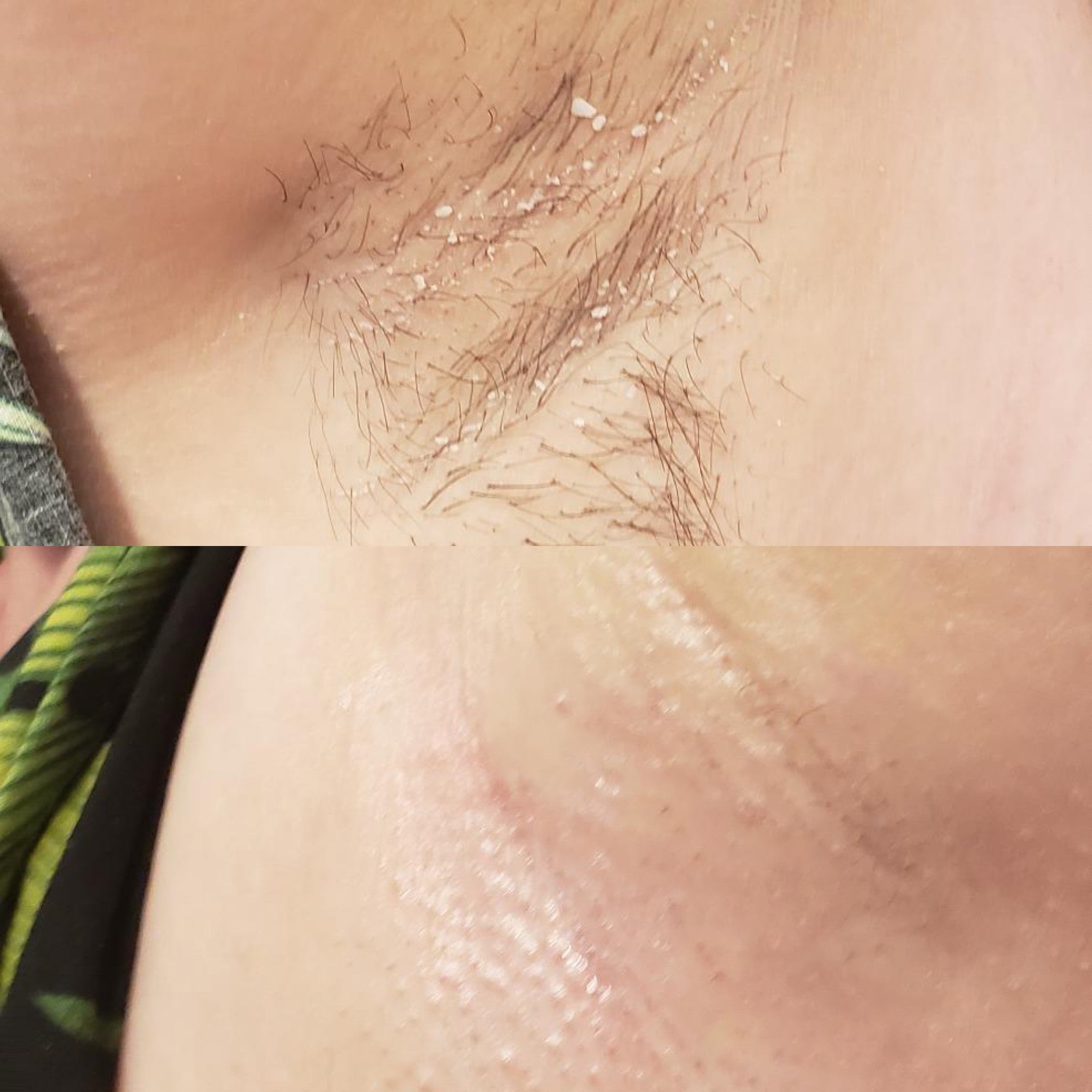 before-after-image